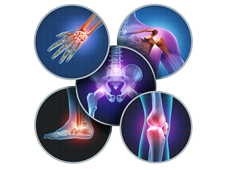 Musculoskeletal-system