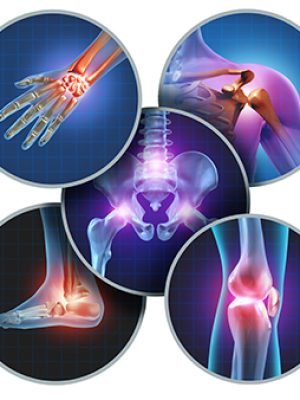 Musculoskeletal-system